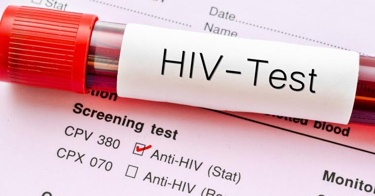 SVETSKI DAN BORBE PROTIV HIV: U SRBIJI OKO 2.000 HIV POZITIVNIH (VIDEO)
